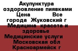 Акупунктура, оздоровление пиявками › Цена ­ 3 000 - Все города, Жуковский г. Медицина, красота и здоровье » Медицинские услуги   . Московская обл.,Красноармейск г.